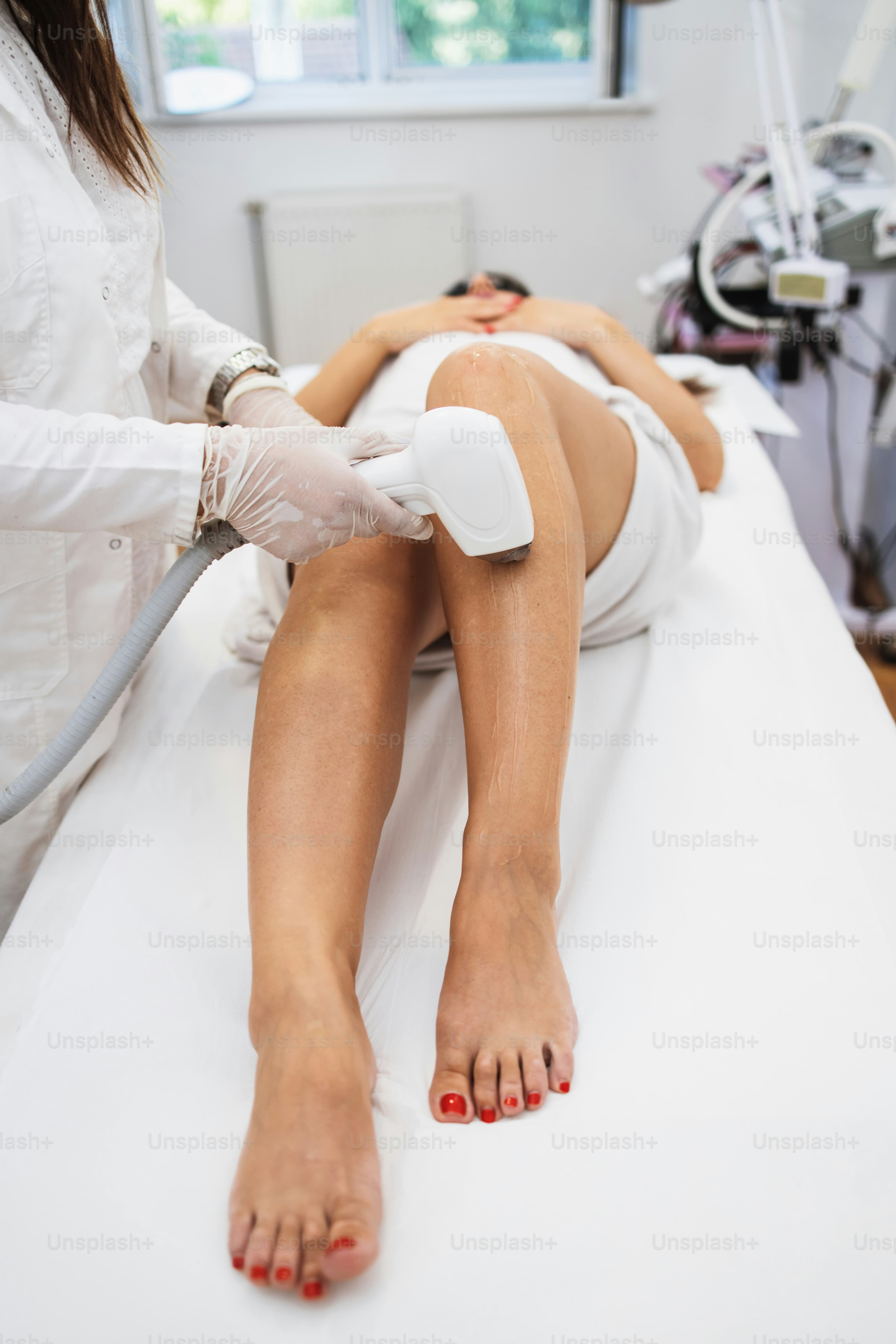 A laser hair removal session on the legs